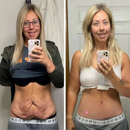 Beviva GLP-1 Parches (30 + 60 GRATIS)